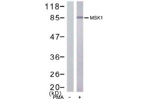 Image no. 1 for anti-Ribosomal Protein S6 Kinase, 90kDa, Polypeptide 5 (RPS6KA5) (Ser376) antibody (ABIN197422) (MSK1 anticorps  (Ser376))