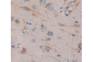 Figure. (DNAJC4 anticorps  (AA 1-150))