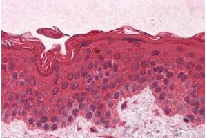 Human Skin: Formalin-Fixed, Paraffin-Embedded (FFPE)
