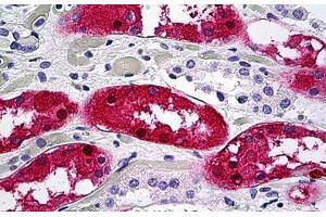 anti-Aminoacylase 1 (ACY1) (AA 1-409) antibody