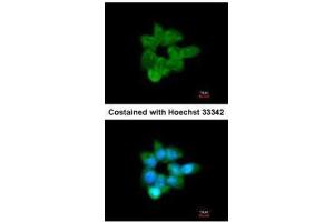 ICC/IF Image Immunofluorescence analysis of methanol-fixed A431, using CLCA1, antibody at 1:200 dilution. (CLCA1 anticorps)