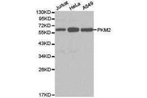Western Blotting (WB) image for anti-Pyruvate Kinase M2 (PKM2) antibody (ABIN1874149) (PKM2 anticorps)