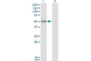 Western Blot analysis of PIK3R1 expression in transfected 293T cell line by PIK3R1 monoclonal antibody (M01), clone 3A10.