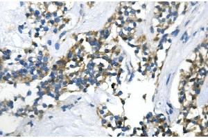 IHC analysis of UBR2 using anti-UBR2 antibody (ABIN7599609). (UBR2 anticorps  (AA 10-664))