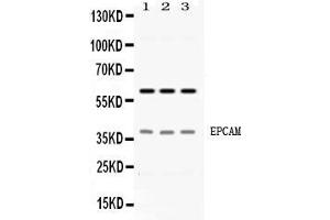 Western blot analysis of EPCAM expression in HELA whole cell lysates ( Lane 1), A549 whole cell lysates ( Lane 2) and PANC-1 whole cell lysates ( Lane 3). (EpCAM anticorps  (Middle Region))