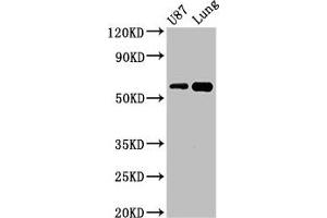 Western Blot Positive WB detected in: U87 whole cell lysate, Mouse lung tissue All lanes: SHC3 antibody at 3 μg/mL Secondary Goat polyclonal to rabbit IgG at 1/50000 dilution Predicted band size: 65, 52 kDa Observed band size: 65 kDa (SHC3 anticorps  (AA 323-468))