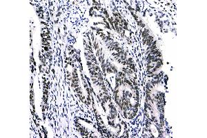 IHC analysis of HP1 gamma using anti-HP1 gamma antibody .