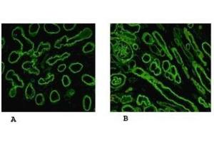 Reactivity of laminin α5 chain specific monoclonal antibody 4B12 on human embryonic lung alveolae epithelium (A) and kidney (B) preparation (Laminin 5 anticorps)