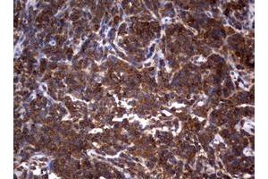 Image no. 4 for anti-Tuberous Sclerosis 1 (TSC1) (AA 836-1164) antibody (ABIN1491686)