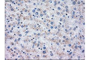 Immunohistochemical staining of paraffin-embedded liver tissue using anti-OXSR1mouse monoclonal antibody. (OXSR1 anticorps)