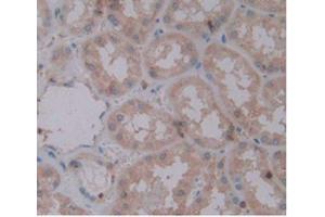 Figure. (IL1A anticorps  (AA 113-271))