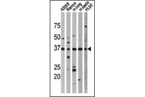 Western blot analysis of anti-Phospho-p53-T18 Pab (cat (ABIN389626 and ABIN2839626)) in, from left to right, , Ramos, mouse lung, mouse testis, and HL60 cell line lysates. (p53 anticorps  (pThr18))