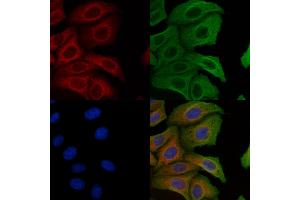 ABIN6257631 and ABIN6274765 staining Hela cells by IF/ICC. (RPL10A anticorps  (C-Term))