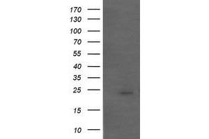 Image no. 1 for anti-Amyloid P Component, Serum (APCS) antibody (ABIN1500899) (APCS anticorps)