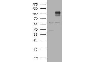 Western Blotting (WB) image for anti-ADAM Metallopeptidase with thrombospondin Type 1 Motif, 8 (ADAMTS8) antibody (ABIN2715722) (ADAMTS8 anticorps)
