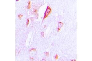 Immunohistochemical analysis of Cytochrome P450 1A1/2 staining in human brain formalin fixed paraffin embedded tissue section.