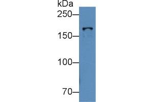 Western Blot; Sample: Human K562 cell lysate; Primary Ab: 2µg/mL Rabbit Anti-Mouse TOP2b Antibody Second Ab: 0.