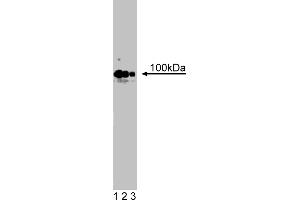 Western Blotting (WB) image for anti-Cadherin 4 (CDH4) (AA 22-201) antibody (ABIN967954)
