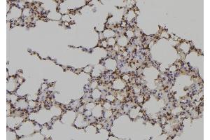 ABIN6276956 at 1/100 staining Mouse lung tissue by IHC-P. (DLC1 anticorps  (N-Term))