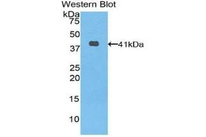 Detection of Recombinant KRT6A, Human using Polyclonal Antibody to Keratin 6A (KRT6A) (KRT6A anticorps  (AA 163-468))