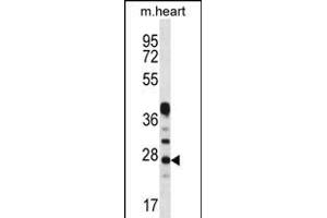 CRYBA1 Antibody (Center) (ABIN656311 and ABIN2845613) western blot analysis in mouse heart tissue lysates (35 μg/lane). (CRYBA1 anticorps  (AA 104-133))