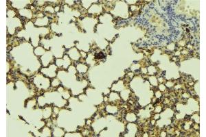 ABIN6277178 at 1/100 staining Mouse lung tissue by IHC-P.