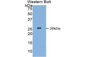 Western blot analysis of the recombinant protein. (XPC anticorps  (AA 734-933))