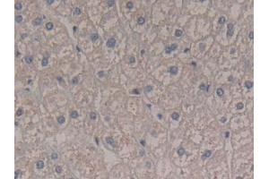 IHC-P analysis of Human Liver Tissue, with DAB staining. (Interferon gamma anticorps  (AA 24-166))