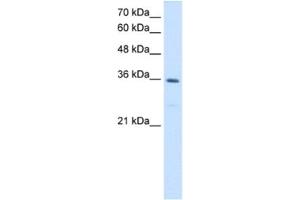 Western Blotting (WB) image for anti-Methylenetetrahydrofolate Dehydrogenase (NADP+ Dependent) 2, Methenyltetrahydrofolate Cyclohydrolase (MTHFD2) antibody (ABIN2462924) (MTHFD2 anticorps)