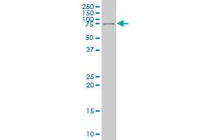 DEAF1 monoclonal antibody (M04), clone 1H8.
