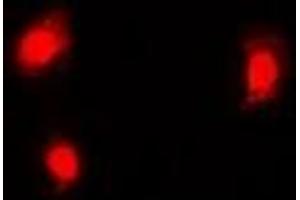 Immunofluorescent analysis of EMSY staining in Hela cells. (EMSY anticorps)