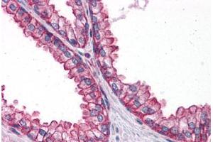 Human Prostate: Formalin-Fixed, Paraffin-Embedded (FFPE) (PTER anticorps  (C-Term))
