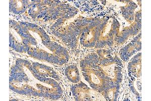 anti-Bone Marrow Stromal Cell Antigen 1 (BST1) (Internal Region) antibody