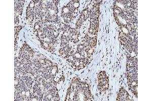 IHC analysis of Cyclophilin E/PPIE using anti-Cyclophilin E/PPIE antibody (ABIN7599242). (PPIE anticorps  (AA 1-301))