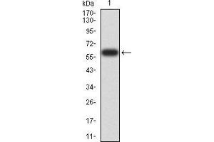 Western blot analysis using DNMT1 mAb against human DNMT1 (AA: 1317-1616) recombinant protein.