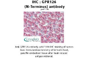 Image no. 1 for anti-G Protein-Coupled Receptor 126 (GPR126) (N-Term) antibody (ABIN1734925)