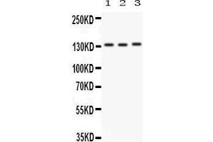 Anti-Integrin alpha 1 antibody, Western blotting All lanes: Anti ITGA1 () at 0. (Integrin alpha 1 anticorps  (C-Term))