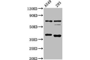 Western Blot Positive WB detected in: A549 whole cell lysate, 293 whole cell lysate All lanes: CTSS antibody at 1:4000 Secondary Goat polyclonal to rabbit IgG at 1/50000 dilution Predicted band size: 38, 32 kDa Observed band size: 38 kDa
