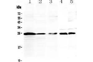 Western blot analysis of IL36 alpha using anti-IL36 alpha antibody . (IL36A/IL1F6 anticorps  (AA 6-158))