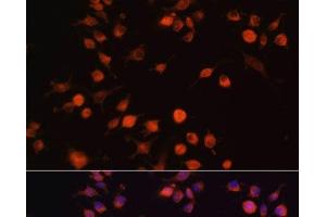 Immunofluorescence analysis of RAW264. (FAK anticorps)
