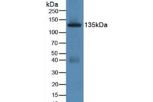 Figure. (JAG1 anticorps  (AA 470-834))