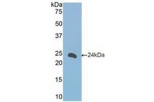 Detection of Recombinant FceRII, Mouse using Polyclonal Antibody to Cluster Of Differentiation 23 (CD23) (FCER2 anticorps  (AA 150-330))