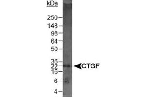 Western blot analysis of CTGF in mouse kidney lysate using CTGF polyclonal antibody .