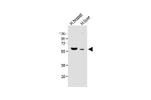 All lanes : Anti-FADS2 Antibody (N-term) at 1:1000 dilution Lane 1: Human breast lysate Lane 2:Human liver lysate Lysates/proteins at 20 μg per lane.