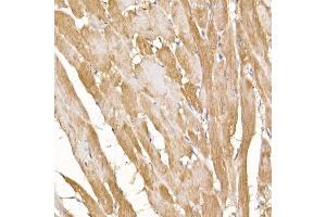 Immunohistochemistry of paraffin-embedded rat heart using COX7 Rabbit pAb (4721) at dilution of 1:100 (40x lens).