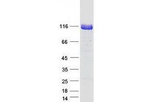 Validation with Western Blot