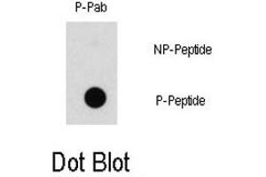 Dot blot analysis of RAF1 (phospho S43) polyclonal antibody  on nitrocellulose membrane.