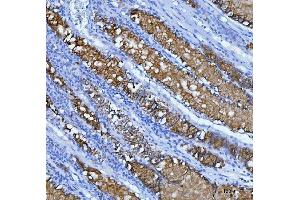 IHC analysis of Mucin-5AC using anti-Mucin-5AC antibody (ABIN3043460). (MUC5AC anticorps  (AA 4848-5030))