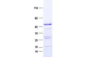 Validation with Western Blot (YBX2 Protein (His tag))