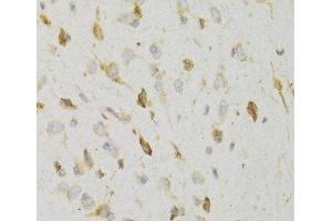 Immunohistochemistry of paraffin-embedded Rat brain using KISS1R Polyclonal Antibody at dilution of 1:100 (40x lens). (KISS1R anticorps)